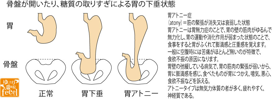 胃アトニー 香川県 観音寺三豊のスポーツ整体なら ゆったり整体院フィール 腰痛坐骨神経痛